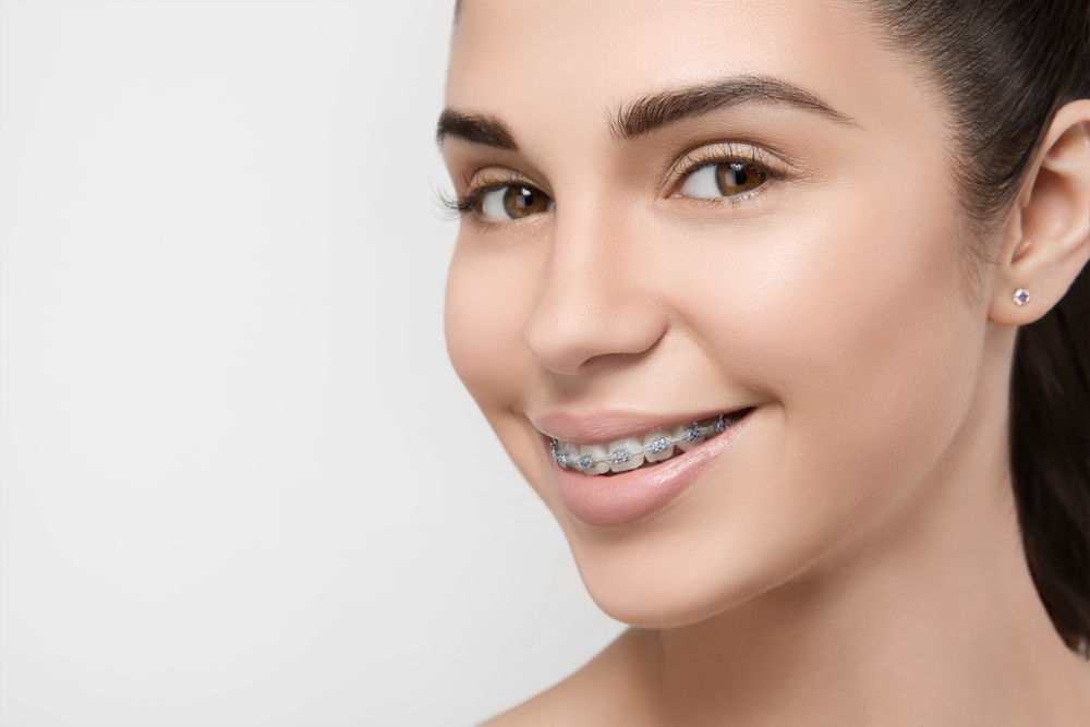 Keeping your braces clean
